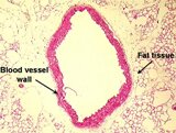 Blood vessel and fat tissue